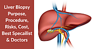 Liver Biopsy Test Specialists at Yashoda Hospital & Research Centre