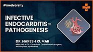 Infective Endocarditis Pathogenesis | @MedvarsityOnlineLtd