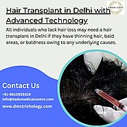 Hair Transplant in Delhi with Advanced Technology - DMC Trichology Clinic
