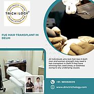 Get Amazing and Advance FUE Hair Transplant in Delhi