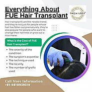 Everything About FUE Hair Transplant in Delhi