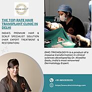 The Top-Rate Hair Transplant Clinic in Delhi - DMC Trichology
