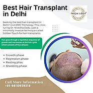 DMC Trichology - Best Hair Transplant in Delhi