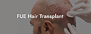 How to Prepare for a FUE Hair Transplant?