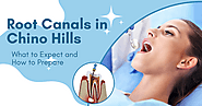 Root Canals in Chino Hills: What to Expect and How to Prepare