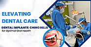 Elevating Dental Care: Dental Implants in Chino Hills for Optimal Oral Health