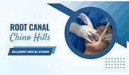 Finding the Right Dentist for Your Root Canals in Chino Hills: Tips and Considerations
