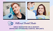 Smile Makeover on a Budget: Unveiling Affordable Dental Implants - Hillcrest Dental Studio