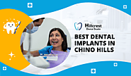Restoring Confidence: Understanding Dental Implants in Chino Hills - Hillcrest Dental Studio