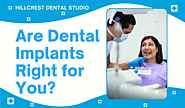Are Dental Implants Right for You? Everything You Need to Know - Hillcrest Dental Studio