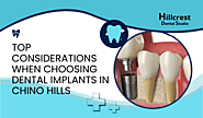 Top Considerations When Choosing Dental Implants in Chino Hills – Hillcrest Dental Studio