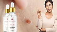 Perfect 10 Skin Tag Remover Reviews (Shark Tank, Exposed 2023) Amarose & Skincell Mole And Best Skin Tag Remover Side...