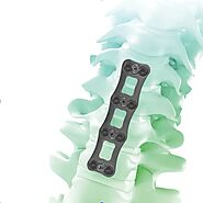 Elevate Surgical Precision with Our Spine Implants