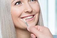 Transform Your Smile with Veneers in Tamiami