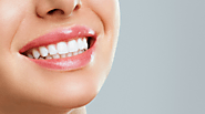 The Shining Smile: Top 9 Benefits of Professional Teeth Whitening