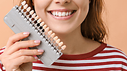Exploring the Many Benefits of Dental Veneers