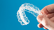 Top Reasons Why Selecting Clear Brace Treatment Is A Wise Decision