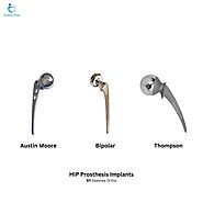 Hip Prosthesis Implants for Surgical Excellence by Zealmax Ortho