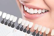 Cosmetic Dentistry, Dental Crowns in Chino Hills - Hillcrest Dental Studio