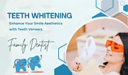 What Are the Latest Trends in Teeth Whitening In Chino Hills? – Hillcrest Dental Studio