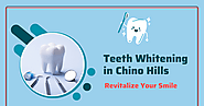 Revitalize Your Smile: Discover Teeth Whitening in Chino Hills