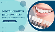 Dental Crowns in Chino Hills: Your Path to a Perfect Smile - Hillcrest Dental Studio