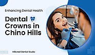 Enhancing Dental Health: All About Dental Crowns in Chino Hills