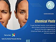 Chemical Peels Pensacola