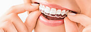 A Full Mouth Reconstruction Often Includes Dental Crowns