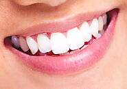 Smile Confidently with Mouth Crowns: Everything You Need to Know