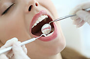 A Comprehensive Guide to Dental Implants: Everything You Need to Know