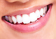 Invisalign Clear Braces: A Seamless Revolutionizing Orthodontic Treatment