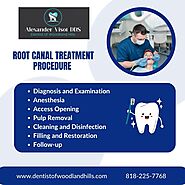 Procedure of Root Canal Treatment in Woodland Hills