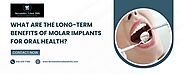 What Are The Long-Term Benefits Of Molar Implants For Oral Health?