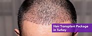 Best Hair Transplant in Delhi, Hair Transplant Surgeon in Delhi NCR