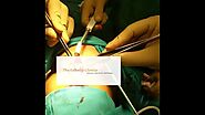 External Rhinoplasty Surgery Performed by DebrajShome