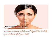 Take The First Step Towards Clear Skin Today With Acne Treatment Dubai - DrypSKin