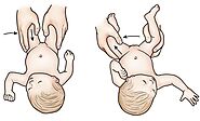 Orthopedic Screening of New Born by Dr Soumya Paik