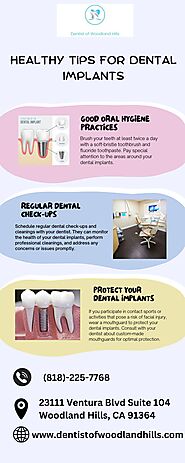 Healthy Tips for Dental Implant after root canal