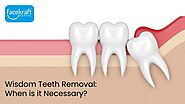 Wisdom teeth removal: When is it necessary? - Face Kraft Clinic