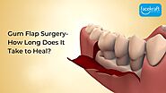 Gum Flap Surgery- How Long Does It Take to Heal? - Face Kraft Clinic