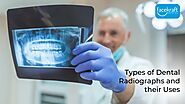 Types of Dental Radiographs and their Uses - Face Kraft Clinic