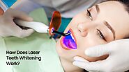 How Does Laser Teeth Whitening Work? - Face Kraft Clinic