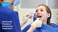 What is the Process of Orthodontic Treatment? - Face Kraft Clinic