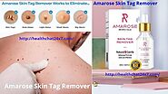 Amarose Skin Tag Remover Reviews Beware Scam Amarose Reviews Skin Tag & Mole Must Read About Customer Review : The Tr...