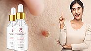 Amarose Skin Tag Remover Reviews (Shocking Updated) Mole and Skin Tag Remover You Should Read Before Buy? | Deccan He...