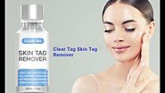 Clear Tag Skin Tag Remover Reviews Fraud Risks Exposed! Must Watch Shark Tank Skin Tag Remover Warning?