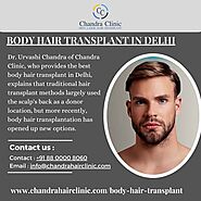 Body Hair Transplant in Delhi - When Does a Surgeon Prefer a Body Hair Transplant?