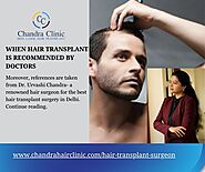When Hair Transplant Is Recommended By Doctors