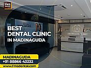 FMS DENTAL Madinaguda-Best Root canal treatment clinic in Madinaguda-Chandanagar:08886643232